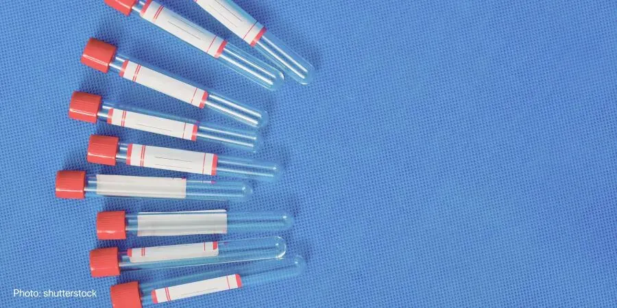 Testing for infections during pregnancy