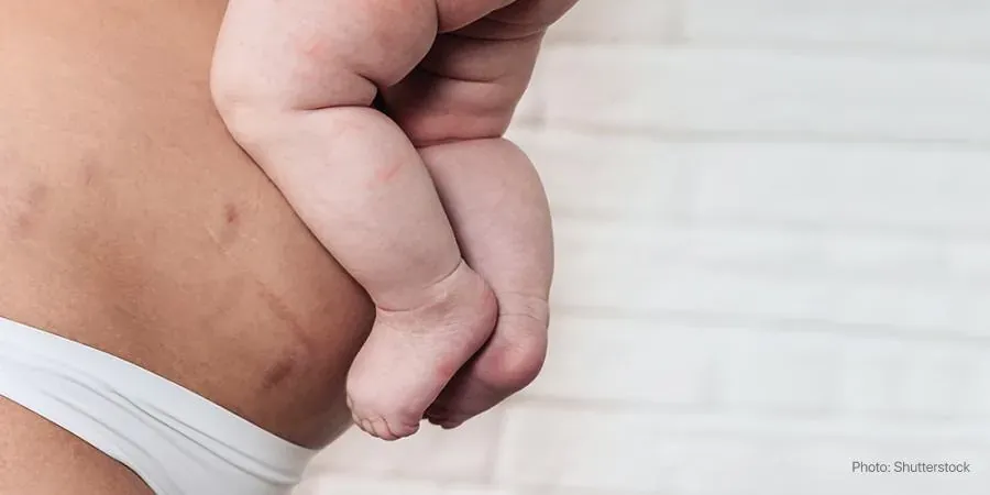 Life after birth: how to accept your new body