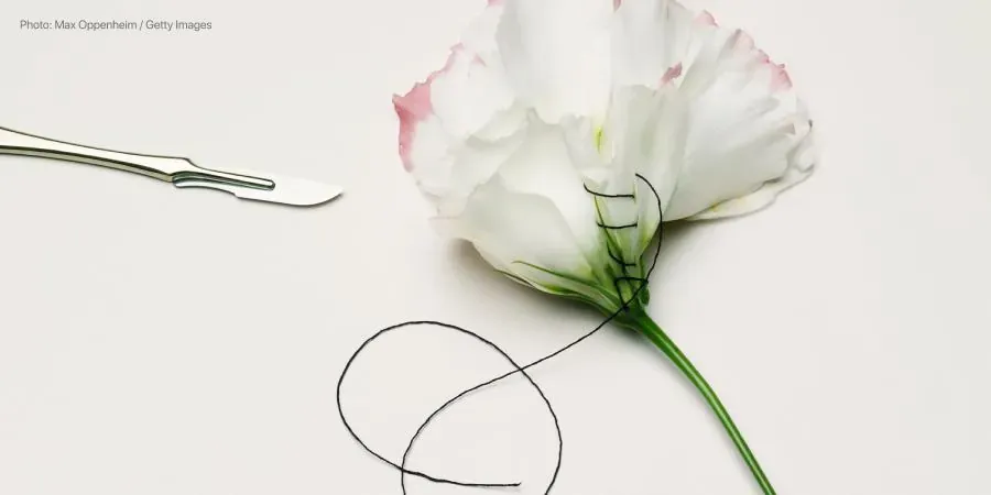 The first days after a C-section