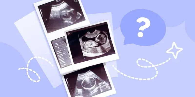 Screening during the second trimester: what doctors look for